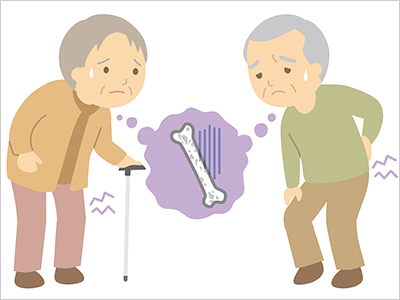 骨粗しょう症による椎体圧迫骨折